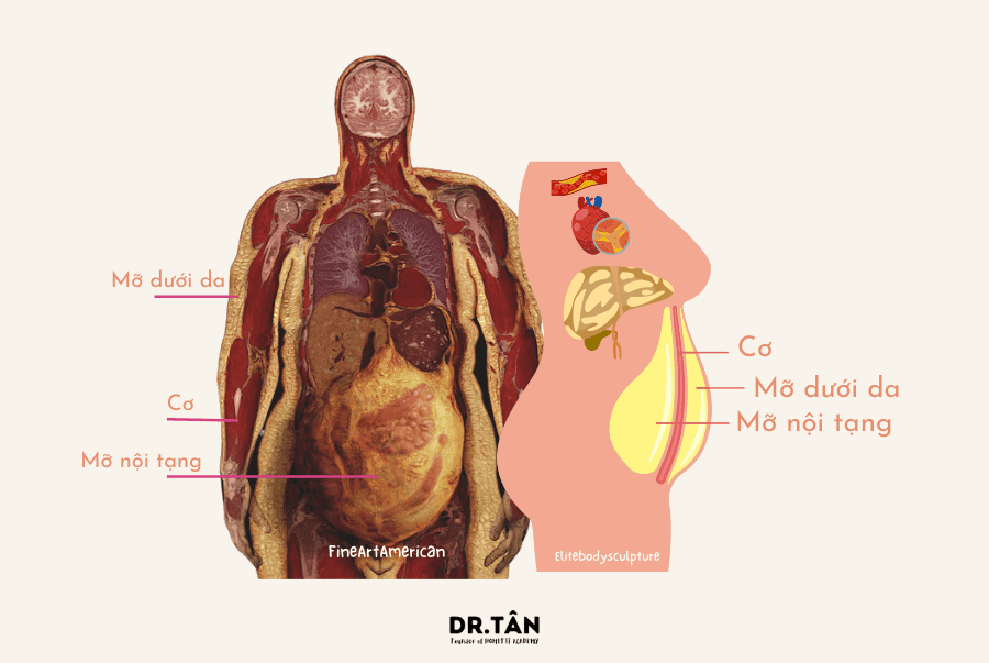 Mỡ Nội Tạng: Những Điều Cần Biết+ Giải Pháp Điều Trị Tự Nhiên Đã Được Chứng Minh