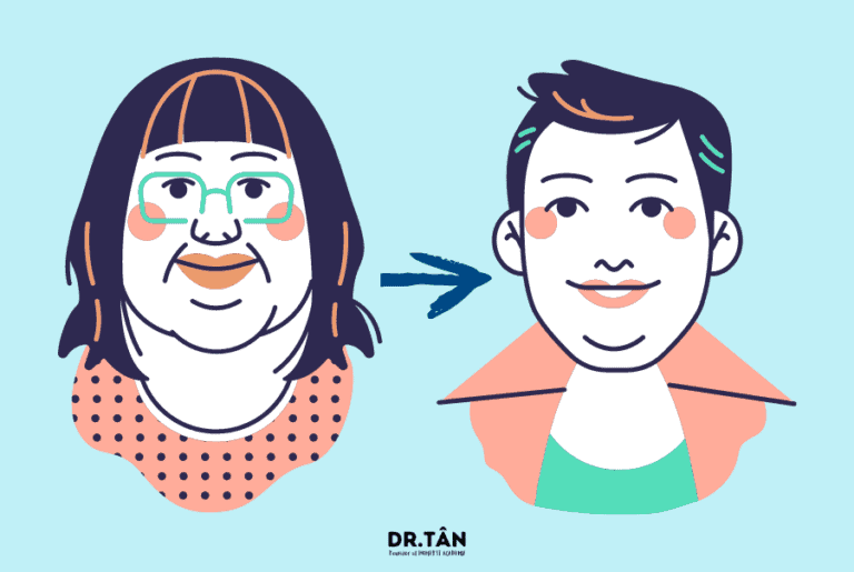 53-giam-mo-vung-mat_1