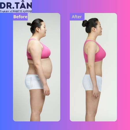 Bí quyết giảm béo sau sinh nhanh nhất, an toàn và hiệu quả